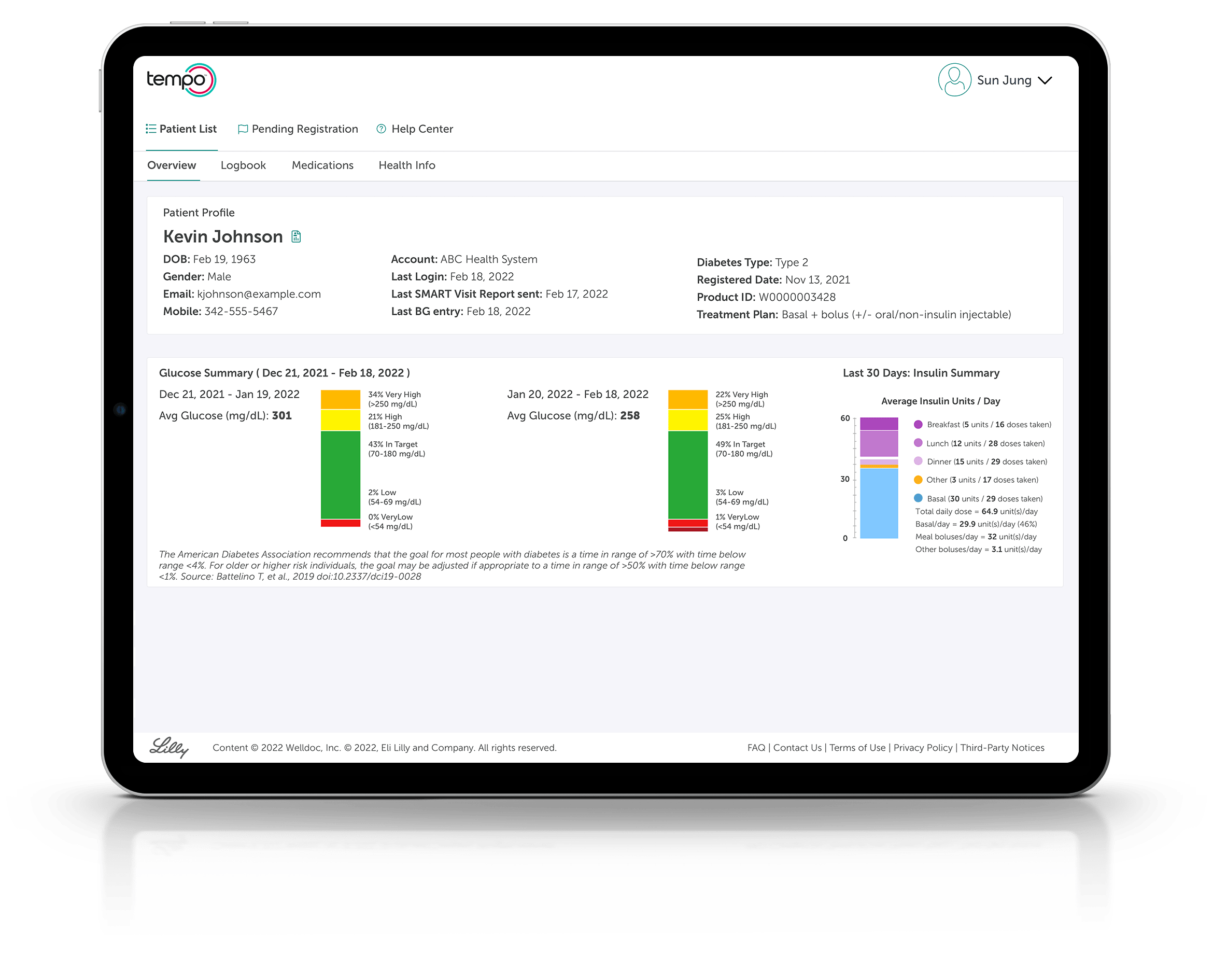 Tempo Insights screens populate on a tablet screen as the user scrolls through corresponding features