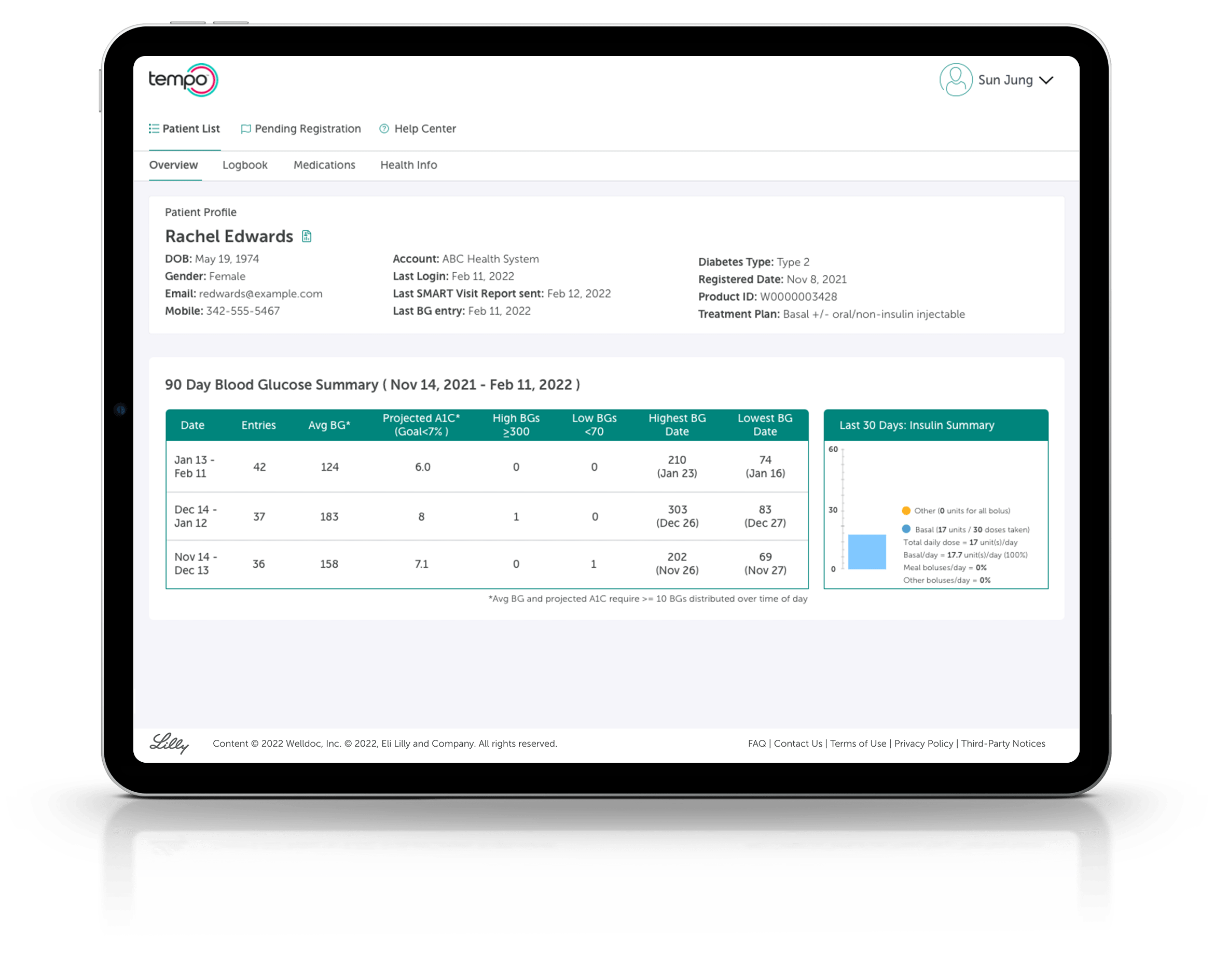 Tempo Insights screens populate on a tablet screen as the user scrolls through corresponding features